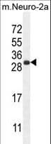 Polyclonal Rabbit anti-Human BHLHA15 Antibody (aa160-189, WB)