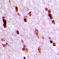 UBQLN4 Antibody (Internal)