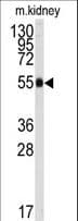 ALDH9A1 Antibody (aa445-477)