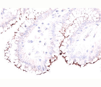 Polyclonal Rabbit anti-H. pylori Helicobacter pylori Antibody (IHC, IF)