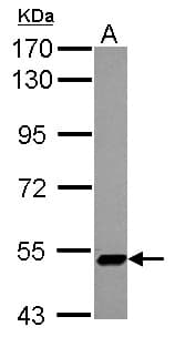 ZNF329 Antibody