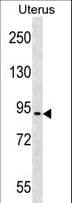 Polyclonal Rabbit anti-Human ASTE1 Antibody (aa29-55, WB)