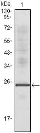 IHC-plus™ IL1A / IL-1 Alpha Antibody (clone 3A6F11)