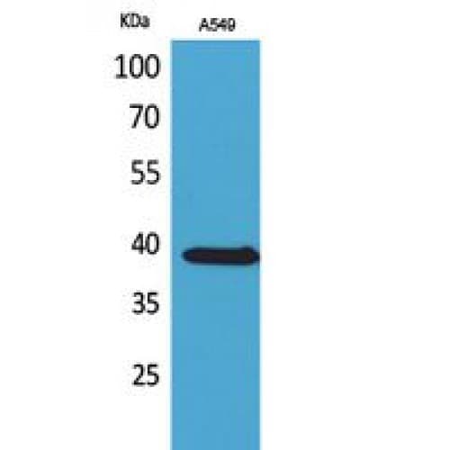 Polyclonal Rabbit anti-Human SLC10A1 / NTCP Antibody (281-330 aa, C-terminal, IHC, WB)