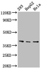 PTGR2 / PGR2 Antibody