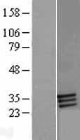 Human FBP / FOLR2 Protein (Over-Expression Lysate Myc-DDK (Flag))