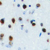 Polyclonal Rabbit anti-Human LYL1 Antibody (Internal, IHC, WB)