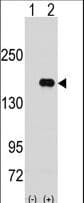 IHC-plus™ Polyclonal Rabbit anti-Human PUM2 Antibody (aa133-162, IHC, WB)