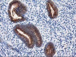 TUBB4 / Tubulin Beta 4 Antibody (clone 3C12, Carrier-free)