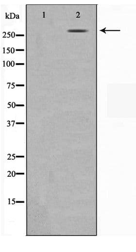 Polyclonal Rabbit anti-Human N-CoR / NCOR1 Antibody (IHC, WB)