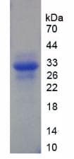 Human ERCC5 / XPG Protein (Recombinant His-T7)