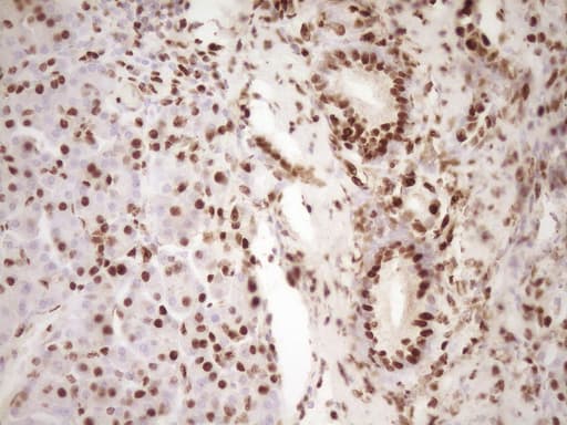 SAE1 Antibody (clone OTI6C7, Carrier-free)