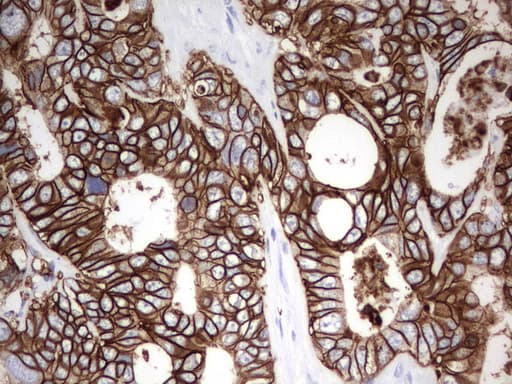 Monoclonal Mouse anti-Human EPCAM Antibody (clone UMAB131, IHC, WB)