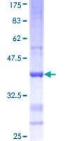 Human AMY2B Protein (Recombinant GST, N-terminus)