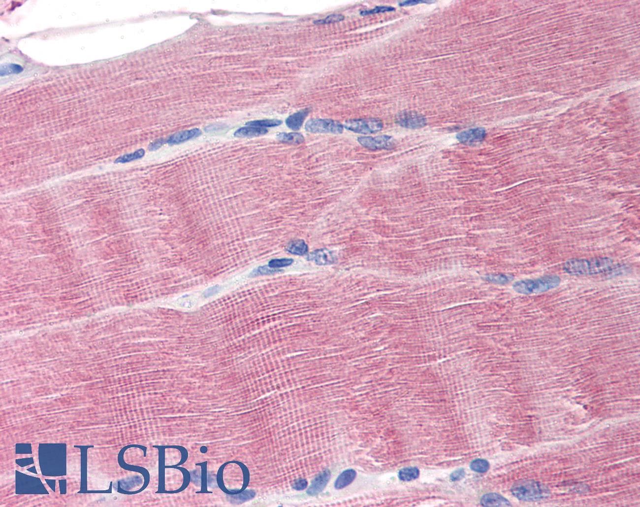 IHC-plus™ SLC40A1 / Ferroportin-1 Antibody (N-Terminus)
