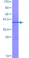 Human MTTP / MTP Protein (Recombinant GST)