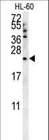 COQ7 Antibody (aa162-191)