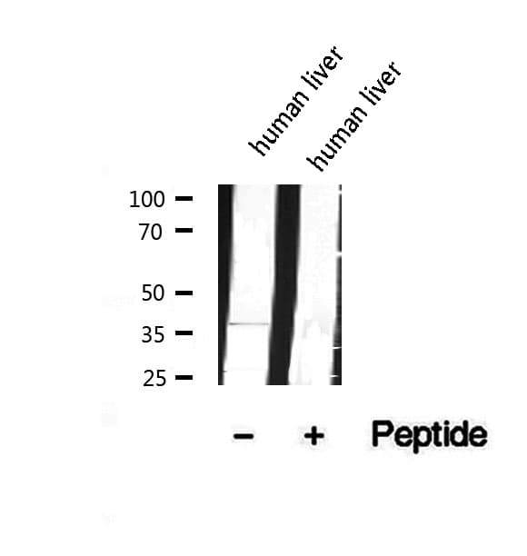COQ9 Antibody