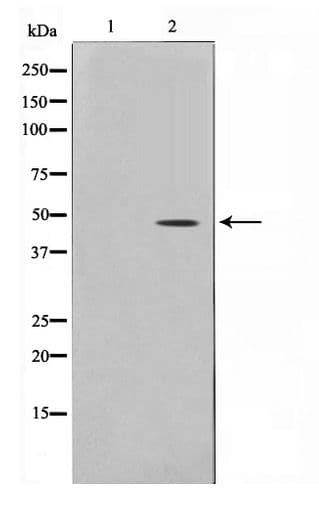 TRIP13 Antibody