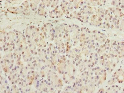 CCDC116 Antibody (Coiled-coil domain)