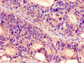 PROKR2/Prokineticin Receptor 2 Antibody