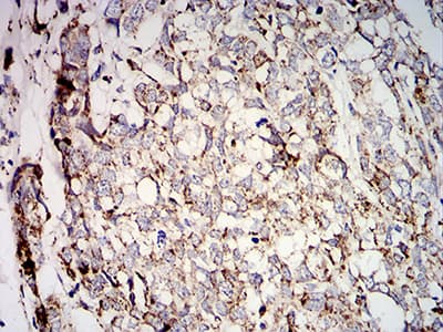 Monoclonal Mouse anti-Human SOD2 / Mn SOD Antibody (clone 8H3F9, IHC, WB)