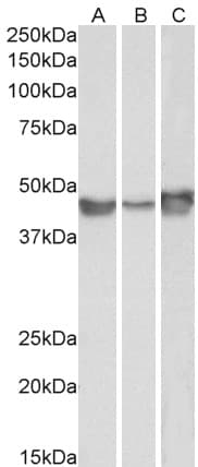 IHC-plus™ SERPINE1 / PAI-1 Antibody (aa71-85)