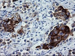 Monoclonal Mouse anti-Human ERBB2 / HER2 Antibody (clone OTI4G7, Carrier-free, aa676-1255, IHC, WB)
