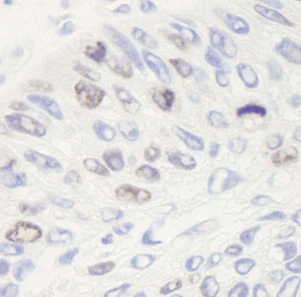 TOP2A / Topoisomerase II Alpha Antibody (aa1500-C-term)
