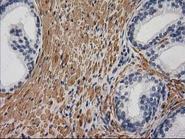 DES / Desmin Antibody (aa104-391, clone 4G1, Carrier-free)