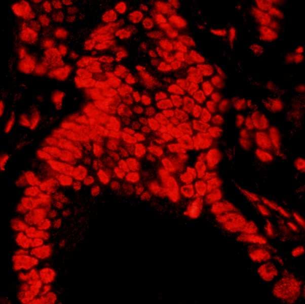 IHC-plus™ Polyclonal Rabbit anti-Human MATR3 / Matrin 3 Antibody (aa800-C-term, IHC, IF, WB)