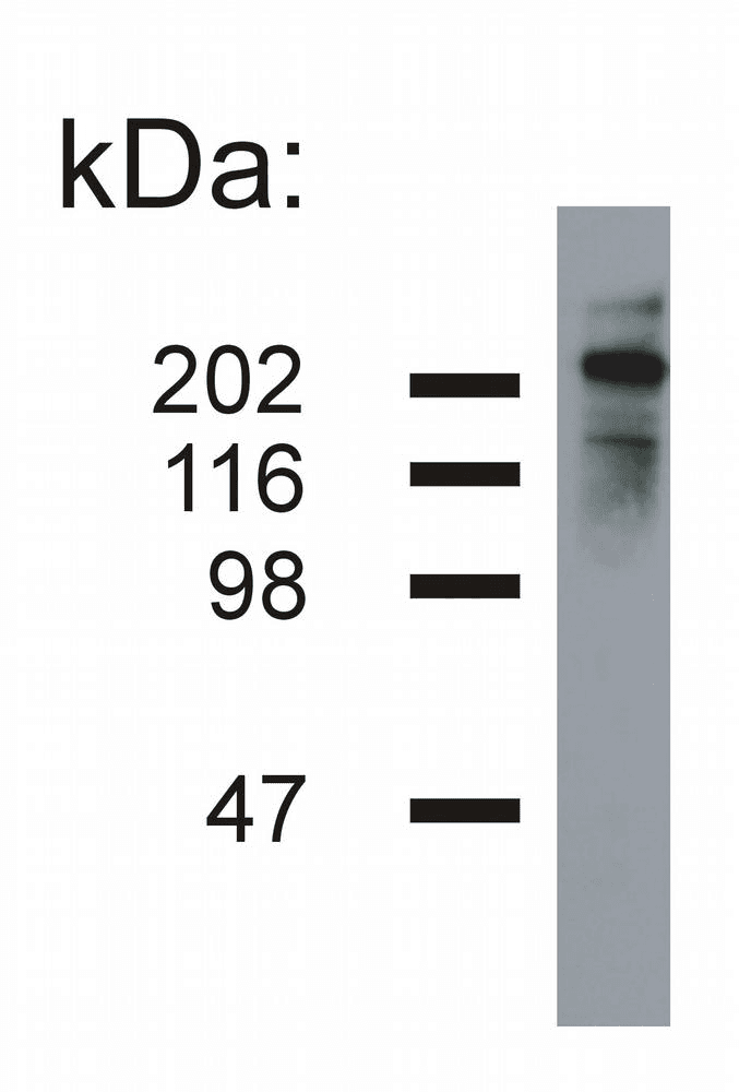IHC-plus™ Monoclonal Mouse anti-Human NEFH / NF-H Antibody (clone NF-05, IHC, WB)