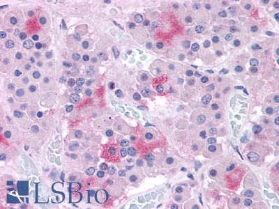 PathPlus™ CASR/Calcium Sensing Receptor Antibody (N-Terminus)