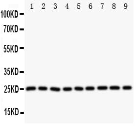 Polyclonal Rabbit anti-Human SOD2 / Mn SOD Antibody (aa45-62, IHC, WB)