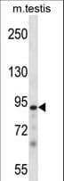 Polyclonal Rabbit anti-Mouse PKN3 Antibody (aa1-30, WB)