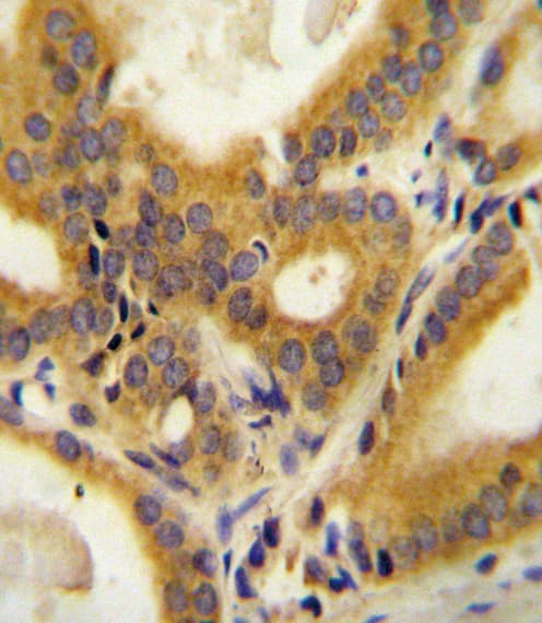 CCDC85C Antibody (aa56-85)