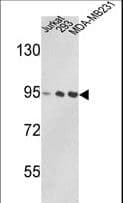 IHC-plus™ VCP Antibody (aa726-755)