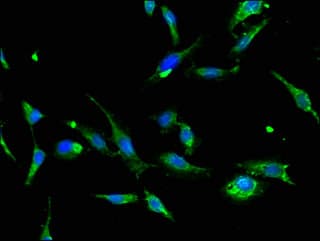 AQP2 / Aquaporin 2 Antibody