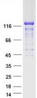 Human STARD13 Protein (Recombinant Myc-DDK (Flag))