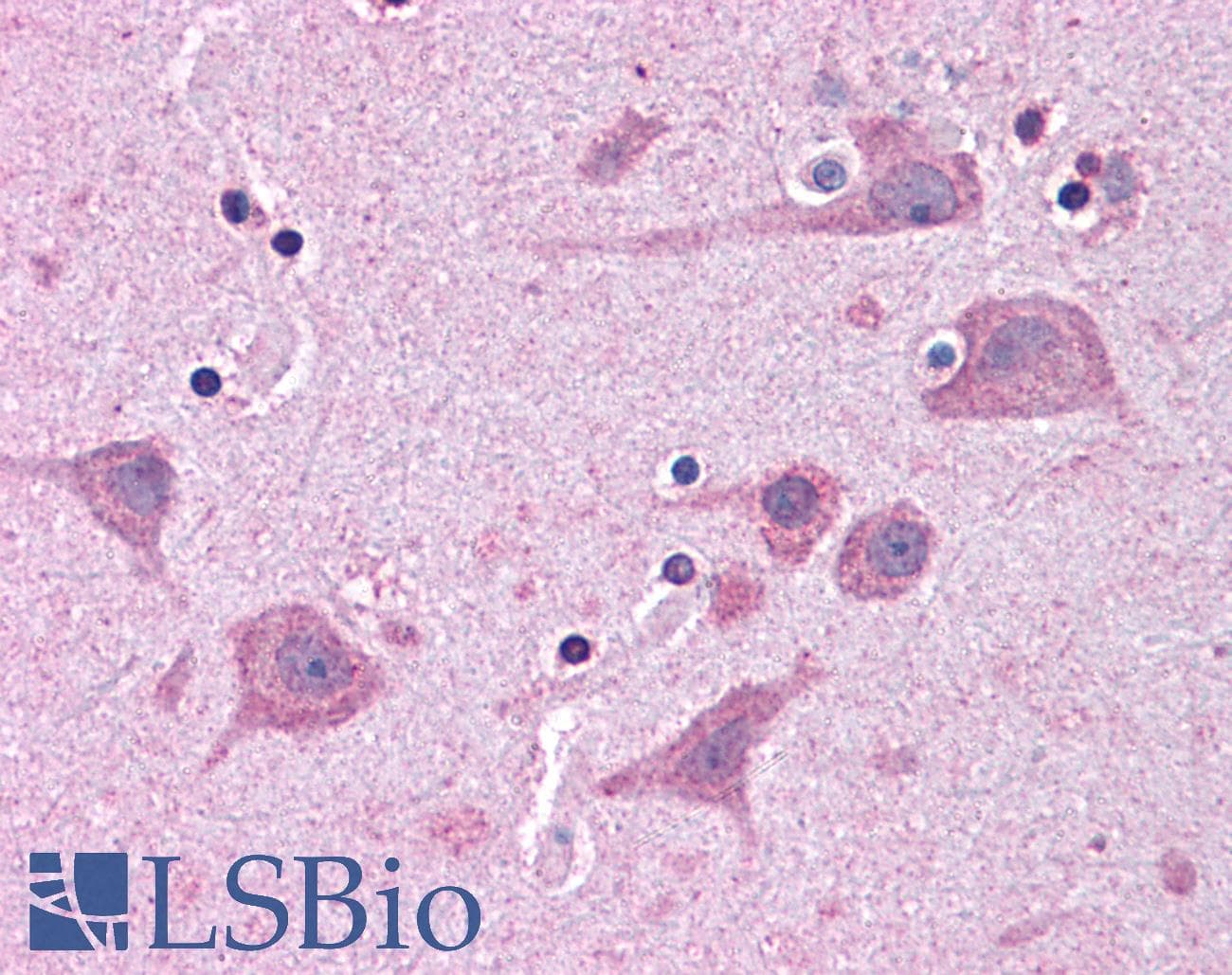IHC-plus™ Polyclonal Goat anti-Human TNKS1BP1 / TAB182 Antibody (aa2-14, IHC, WB)