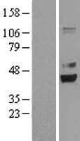 PRPSAP2 Protein (Over-Expression Lysate Myc-DDK (Flag))
