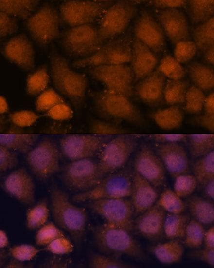 Polyclonal Rabbit anti-Human CEP85 / CCDC21 Antibody (IF)