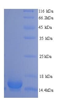 Human PLA2G5 Protein (Recombinant His)