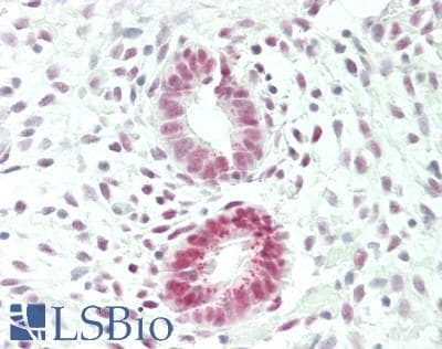 IHC-plus™ Polyclonal Rabbit anti-Human DDX1 Antibody (aa500-550, IHC, WB)