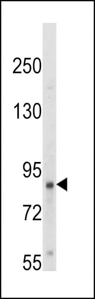 NTRK1 / TrkA Antibody (aa769-796)