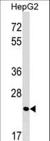 MRTO4 Antibody (aa46-72)