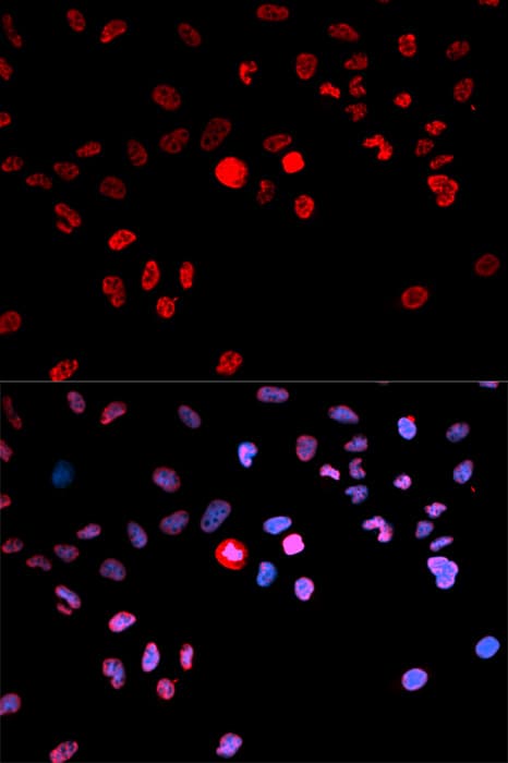 CREB1 / CREB Antibody (phospho-Ser133)
