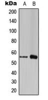 FOXC1+2 Antibody (Internal)