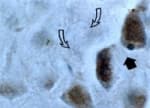 Polyclonal Rabbit anti-Human CASP3 / Caspase 3 Antibody (IHC, WB)