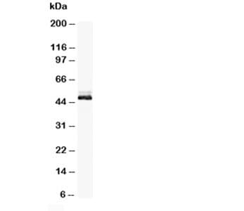 Polyclonal Rabbit anti-Human ENO2 / NSE Antibody (aa420-434, IHC, WB)